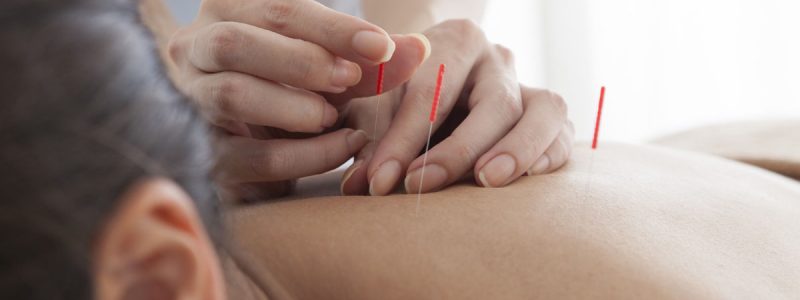 Acupuncture Treatment